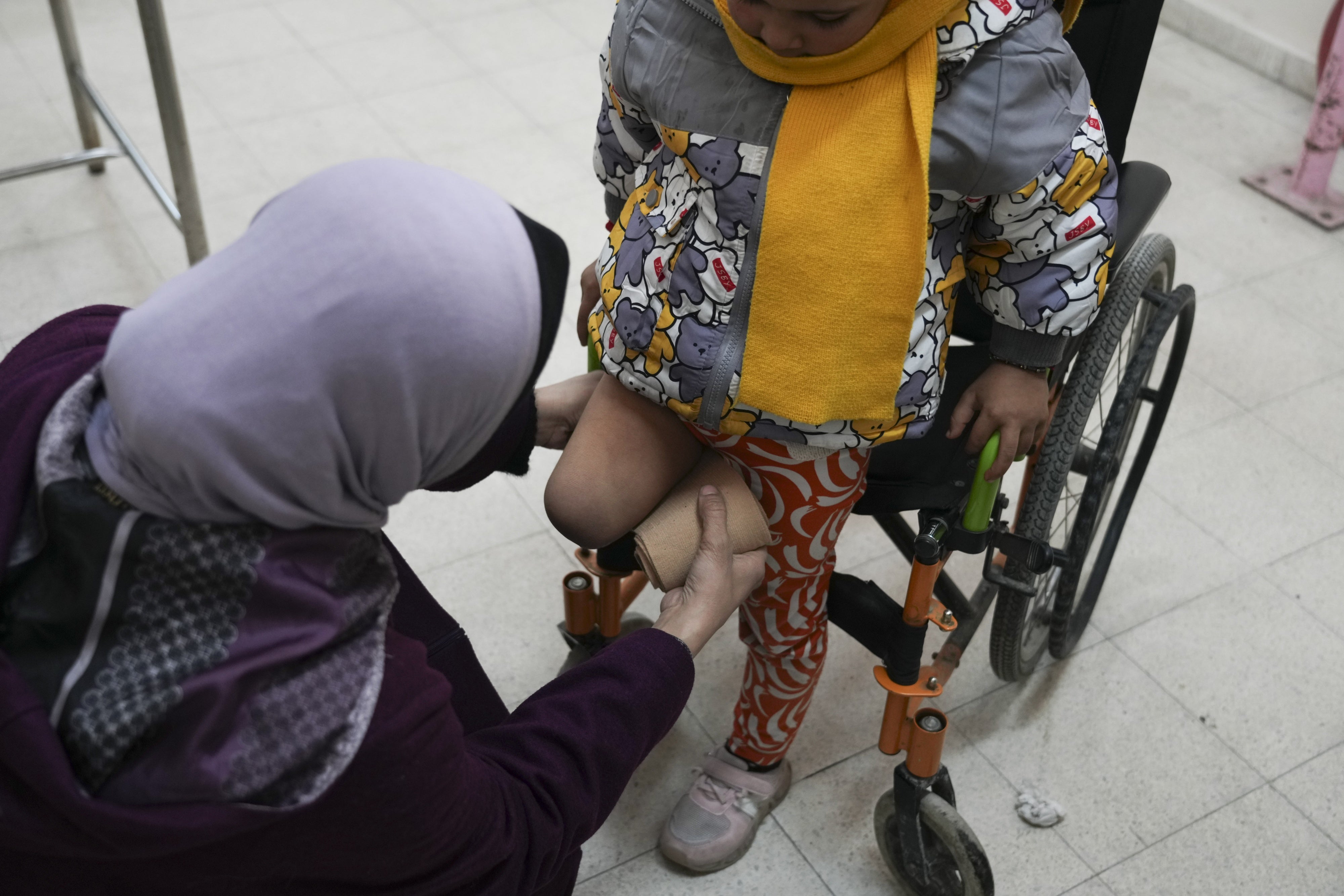 A doctor adjusts the cover on the amputated leg of a 5-year-old Palestinian girl at the Artificial Limbs and Polio Center in Gaza City, February 26, 2025. 