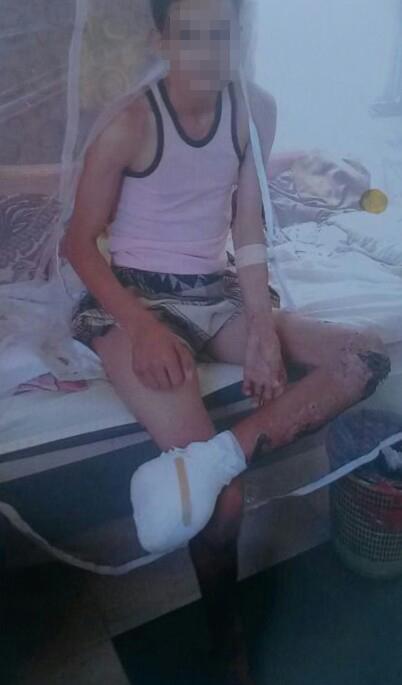 MENA ARMS Yemen Landmines Sept 2016 photo-3 arabic