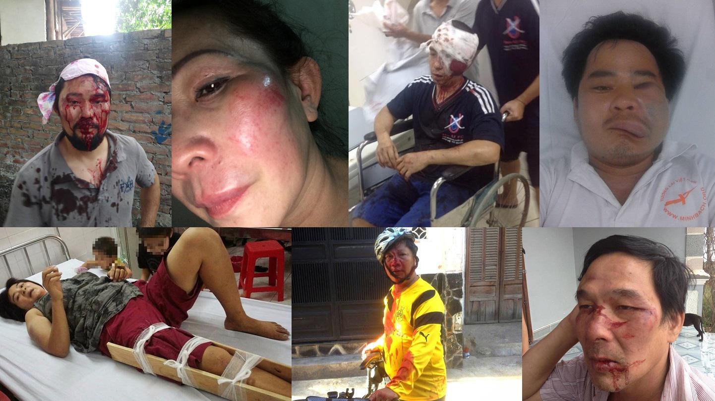 Des activistes vietnamien(ne)s, photographié(e)s après avoir été agressé(e)s par des “voyous” inconnus entre janvier 2015 et avril 2017. En haut, de gauche à droite : Nguyen Chi Tuyen, Nguyen Thi Thai Lai, La Viet Dung et Nguyen Van Thanh. En bas, de gaFR