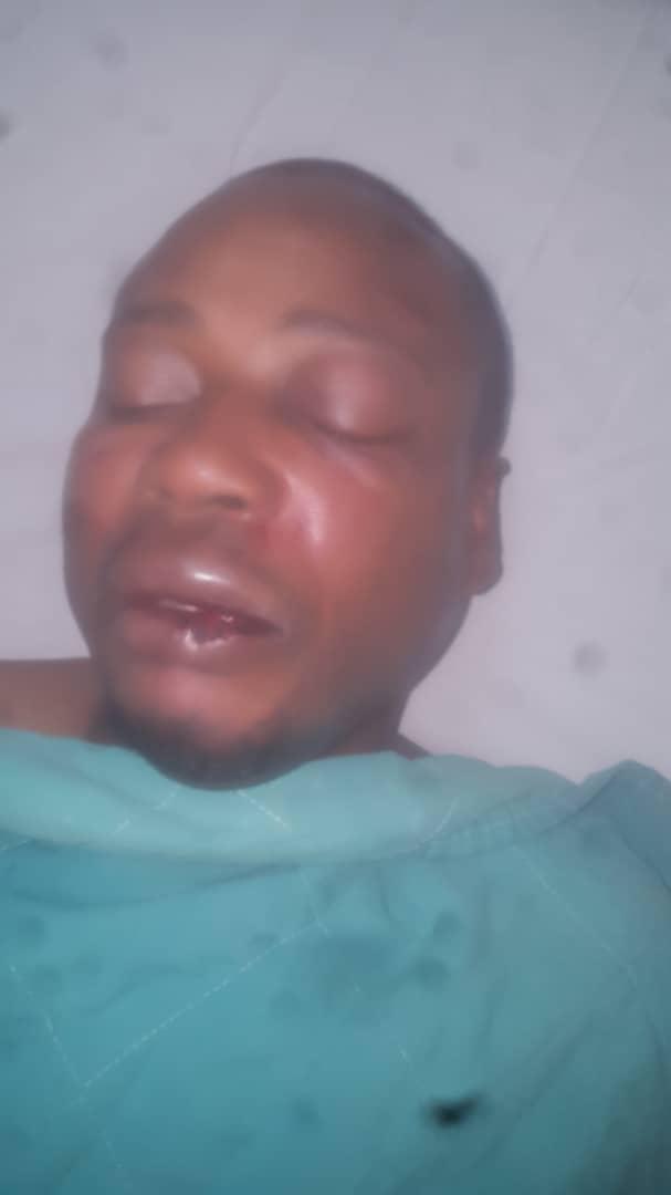 201810Africa_Alfredo_Okenve_Injury