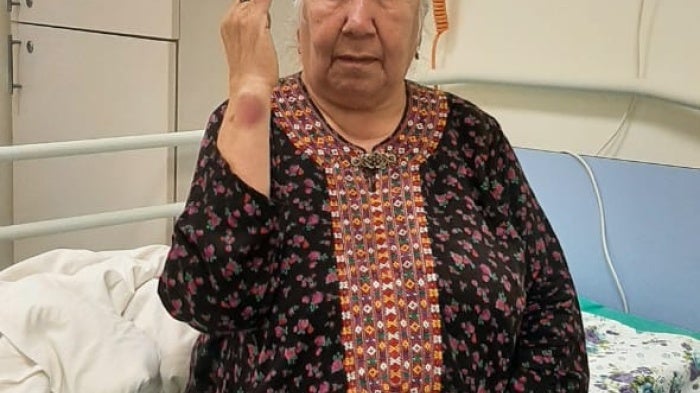 Human rights defender Soltan Achilova, forcibly held in an infectious disease hospital in Ashgabat, Turkmenistan. November 20, 2024. 