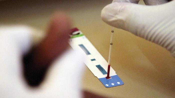 A health worker administers a voluntary HIV test at Chreso Ministries VCT (Voluntary Counseling & Testing) and ART (Anti Retroviral Treatment) Centre in Lusaka. 