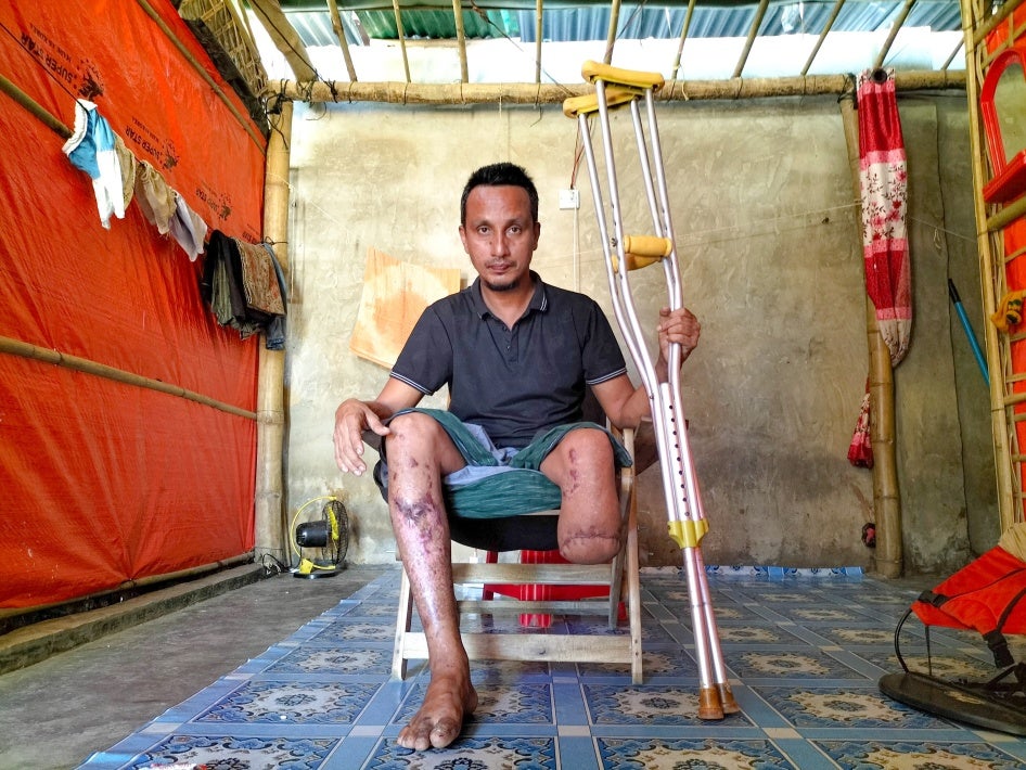 Abdullah lost his lower left leg on August 9, 2024, after stepping on an antipersonnel mine while fleeing his village in Maungdaw, Rakhine State, Myanmar