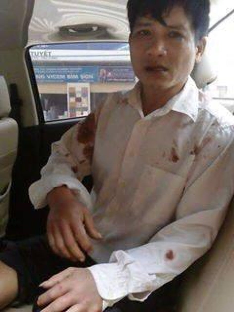 Nguyen Trung Ton after being assaulted in Quang Binh on February 27, 2017. 