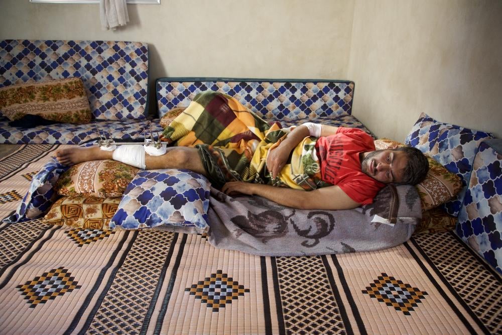 Mahm​​​​​​​oud Hammadi, uncle to the nine-year-old boy who accidentally picked up a dud submunition and dropped it just meters away from him in front of his house, lies on a mattress, his leg injured. His wife was also injured in the incidentattack, Termanin, Syria, October 14, 2023. 