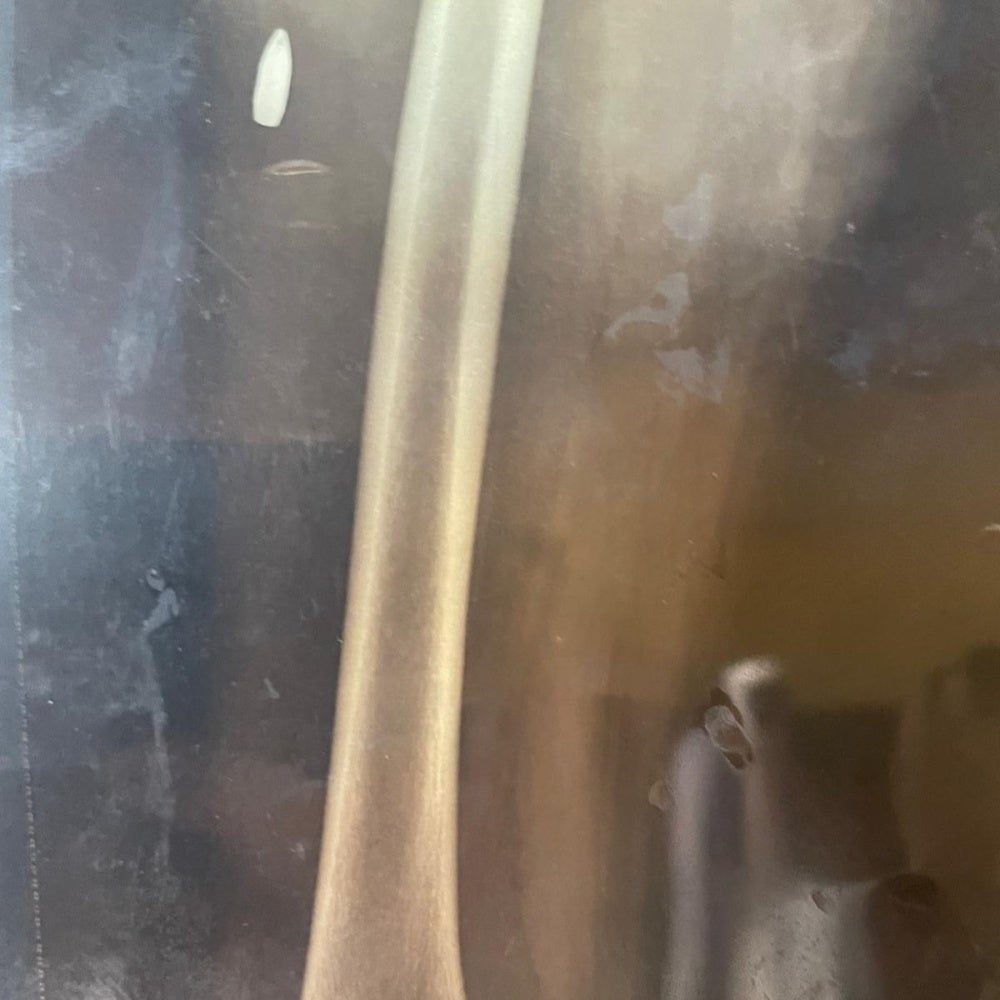 x-ray image of a 17-year-old girl who was struck in the leg by a stray bullet