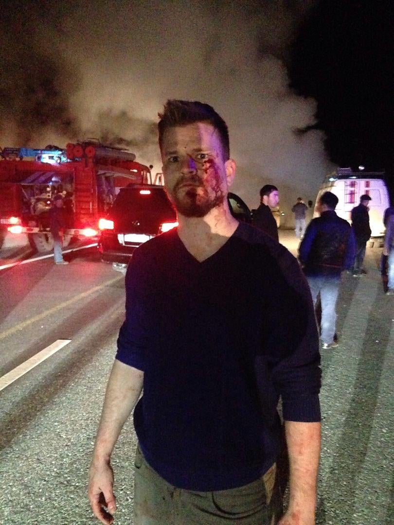 Oeystein Windstad, a correspondent for Norway’s Ny Tid newspaper, after a mob attack on a bus carrying journalists. Ordzhenikidzevskaya, March 2016.