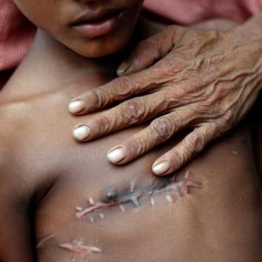 201711Asia_Burma_ShotMohammed Taher, 50, a Rohingya refugee holds his son Mohammed Shoaib, 7, outside a medical center at Kutupalong refugee camp near Cox’s Bazar, Bangladesh, on November 5, 2017. His son was shot in the chest before crossing the border f